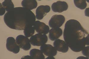 Mugo pine and spruce pollen