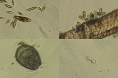 Protozoa