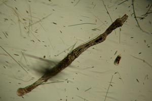 Aeolosoma, Stylonychia