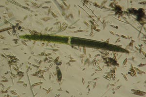 Closterium, euglenid