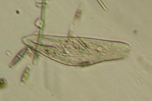 Ciliate