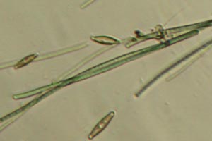 Cyanobacteria