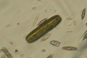 Diatom