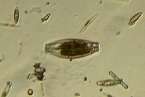 Diatom