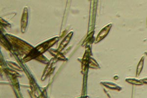 Diatoms