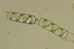 Spirogyra?
