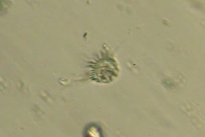 Ciliate