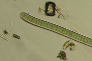 Cyanobacteria