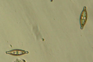 Diatoms