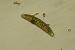 Diatoms