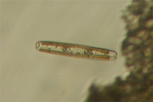 Diatoms