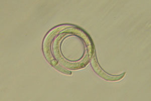 Roundworm