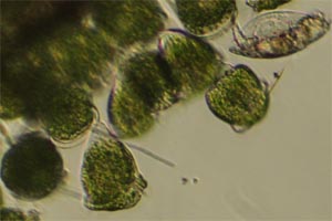 Vorticellids, Lepadella