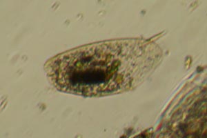 Ciliate
