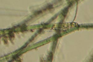 Cyanobacteria