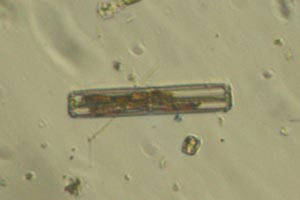 Diatom