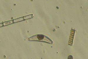 Diatoms