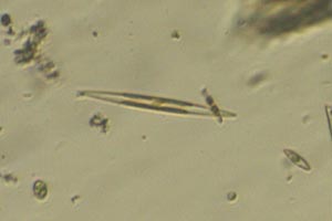 Diatoms