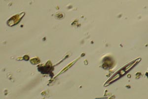 Diatoms
