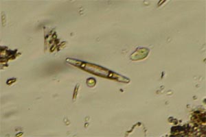 Diatom