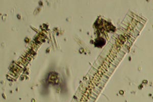 Diatoms