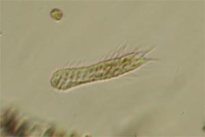 Chaetonotus