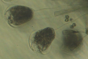 Vorticella