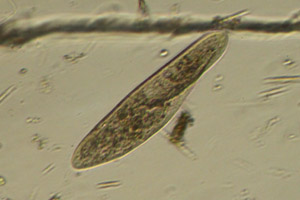 Paramecium