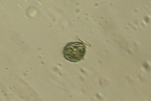 Ciliate