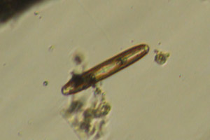 Diatom