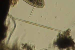 Diatom