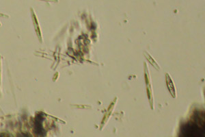Diatoms