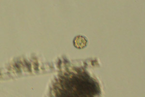 Diatom