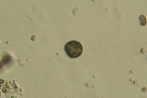 Dinoflagellate