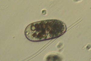 Ciliate