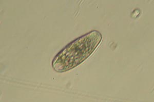 Ciliate
