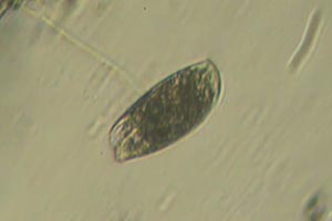 Ciliate