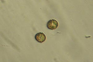 Dinoflagellates