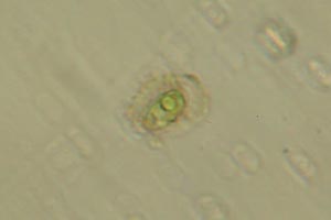 Chlorophyte