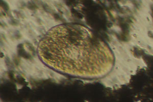 Ciliate