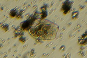 Ciliate