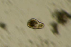Ciliate