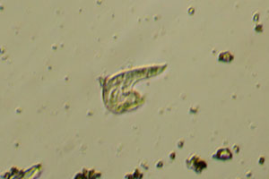 Ciliate