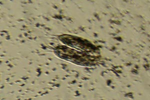 Spirotrichea conjugating