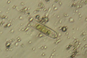 Diatom