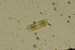Diatom