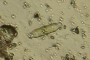 Diatom