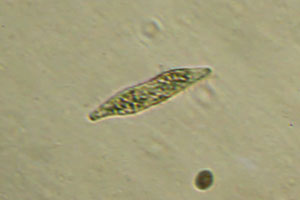 Ciliate