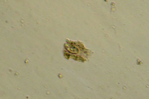 Ciliate