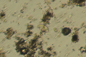 Ciliate
